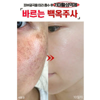 Made in Korea Glutathione Essence Cica Fluid melasma-x Skin soothing moisturizing essence that melts the freckles (1+1+1)(free shipping)